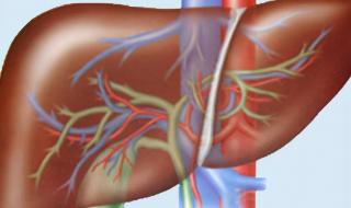 乙肝小红点图片 乙肝小红点图片
